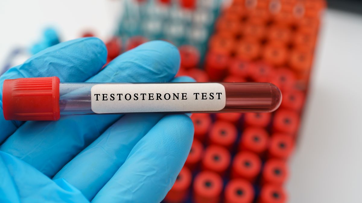 testosterone