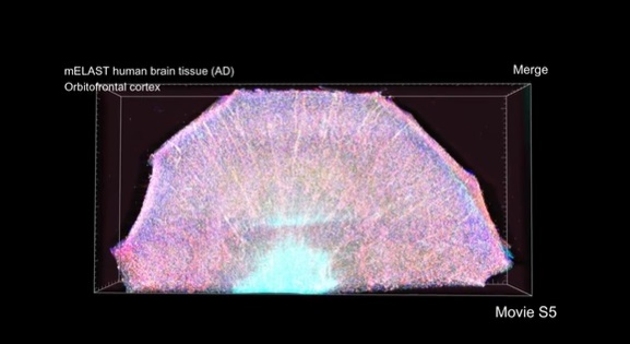 Un viaggio in 3D nel cervello umano